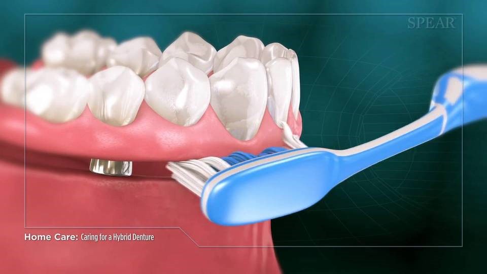 Young Dentures Before 
      And After New Albany KS 66759